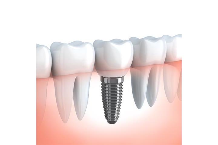 Towngate Family Dental & Ortho image 2