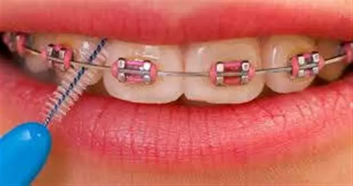 Ele Dental image 1