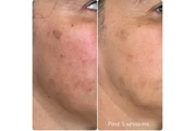 Novel U Wellness & Med Spa thumbnail
