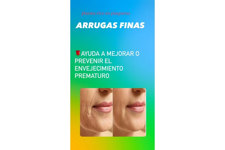 Plasma rico en plaquetas image 5