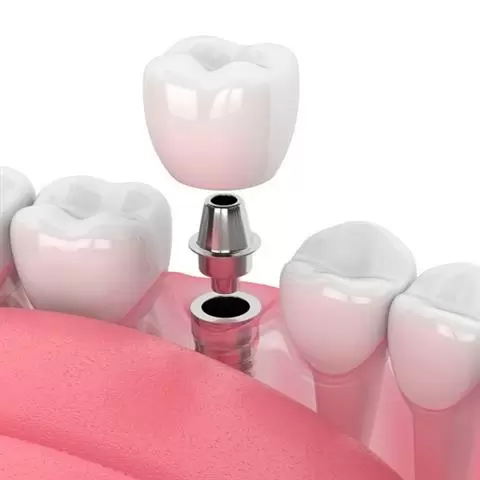 ODONTOLOGÍA COSMETICA image 5