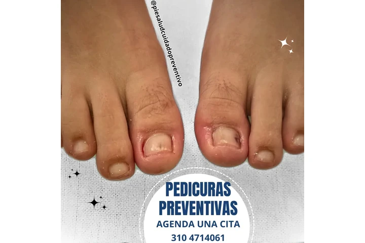 Quiropodia image 3
