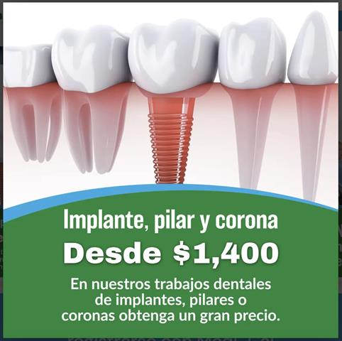 Implantes Dentales image 1