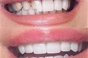 Healthy Smiles, Happy Life! thumbnail