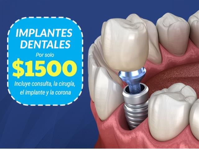 Dentista de Implantes image 1