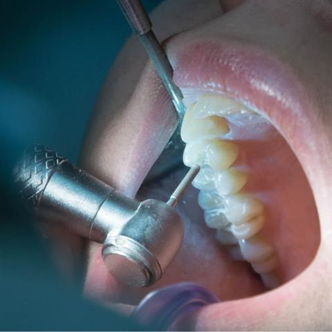 Lower Azusa Dental Group image 7