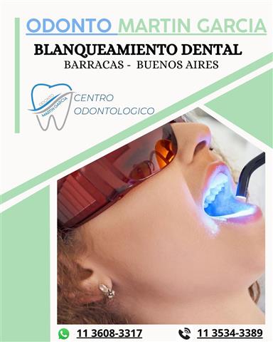 BLANQUEAMIENTO DENTAL image 1