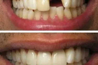 Vista Oasis Smiles en San Diego