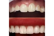 Dentista Cosmético en Los Angeles