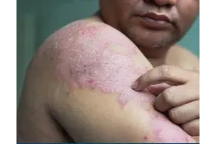 Consulta de Piel Gratis image 1