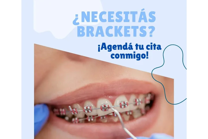 RECUPERA TU HERMOSA SONRISA image 2