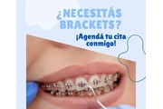 RECUPERA TU HERMOSA SONRISA thumbnail