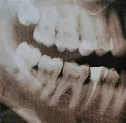 DENTISTA CON PRECIOS BAJOS image 1