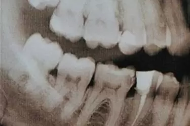 DENTISTA CON PRECIOS BAJOS en Bakersfield