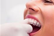 Implantes Dentales en Rialto thumbnail