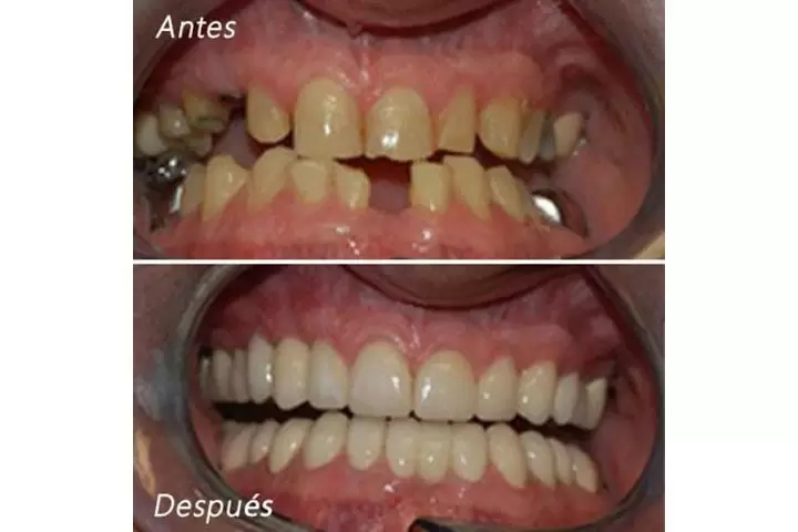 DENTISTA FAMILIAR EN VISTA image 3