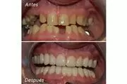 DENTISTA FAMILIAR EN VISTA thumbnail