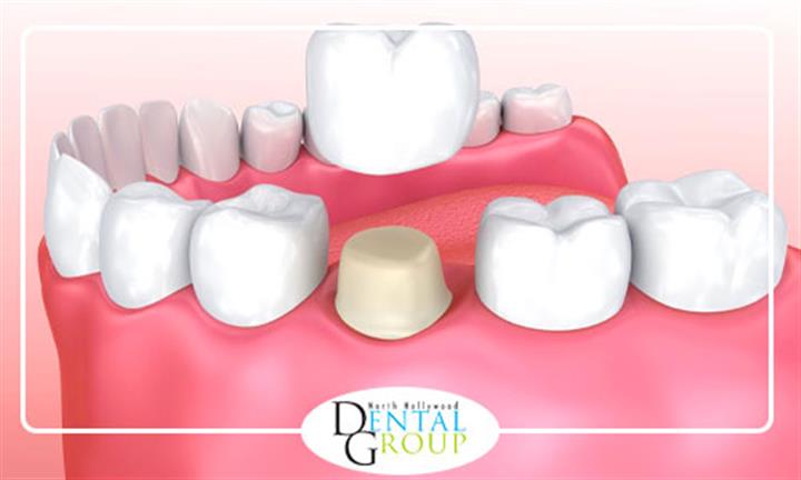 North Hollywood Dental Group image 8