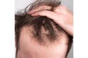 PRODUCTO NATURAL ORGANICO thumbnail 3
