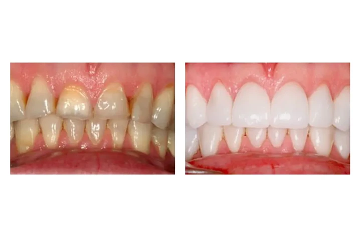 Hutchinson Metro Dental image 8