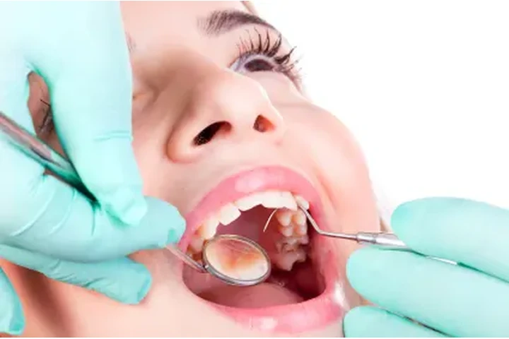Dental Implants Nassau County image 1