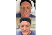 Faciales en Los Angeles