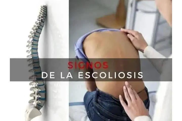 Quiropráctica para la salud image 6