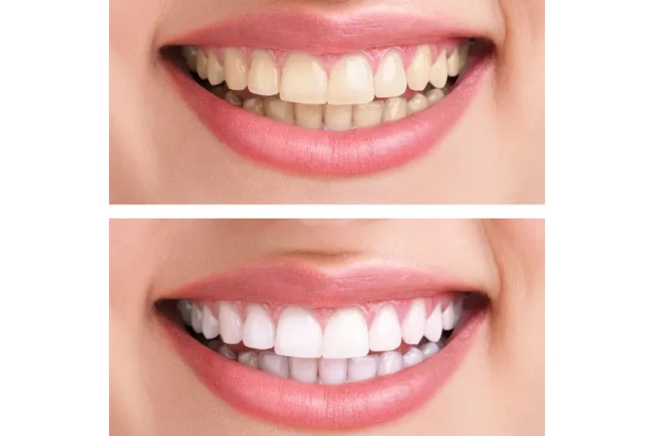 Bui Phuong-Ly Thi - Dentista image 6