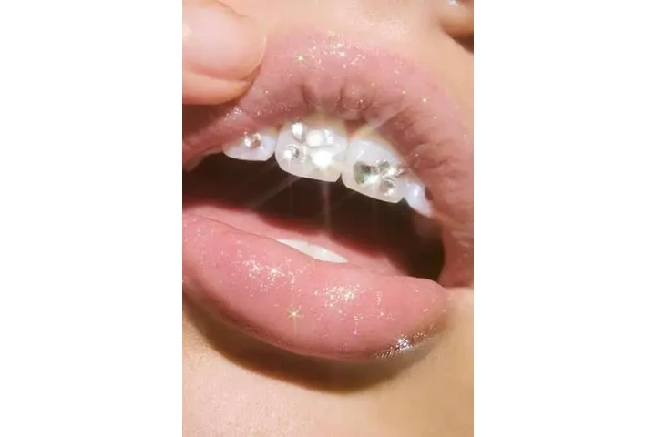 Blanqueamiento Dental $50 dls image 9