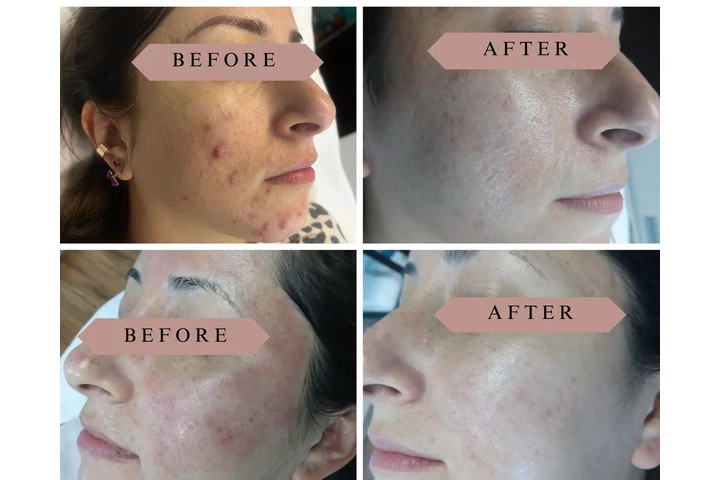 DEPILACION PARA HOMBRE/MUJER image 2