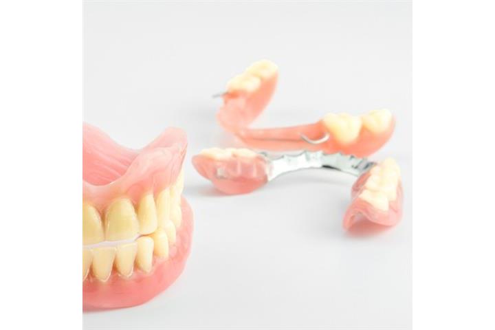 Implantes dentales desde $999 image 2