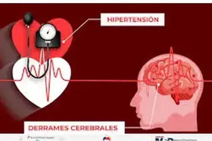 HIPERTENSION Y ESTRES image 1
