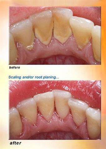 Heavenly Dental Smiles Inc. image 4