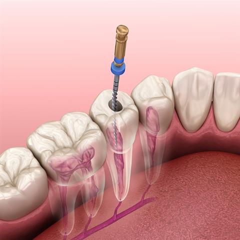 SmileOne Dentistry image 2