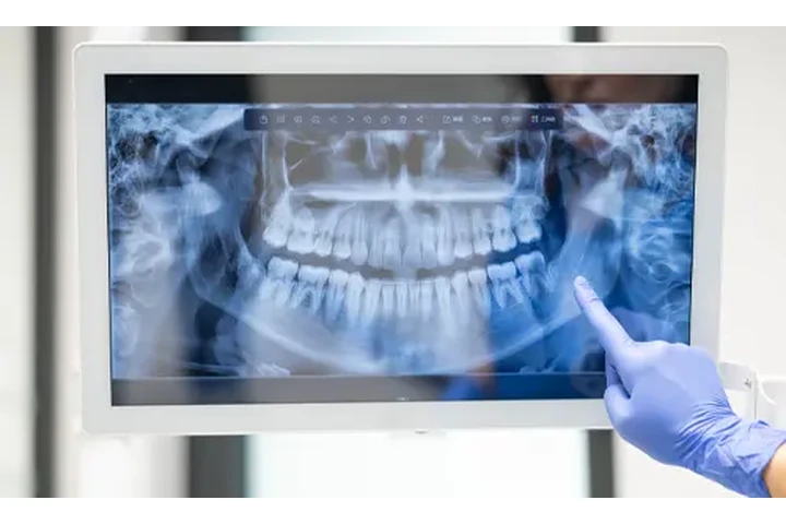 Dentista económico en Lynwood image 9