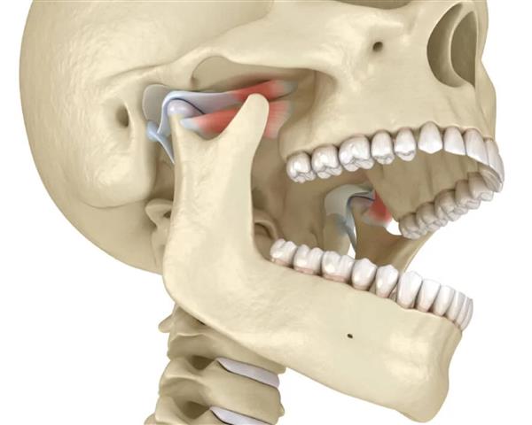 TMJ Treatment in Charleston image 1