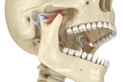 TMJ Treatment in Charleston en Charleston