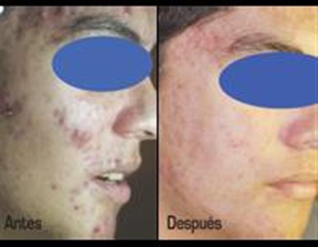 Upper Layers Skin Care image 3