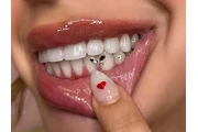 Blanqueamiento Dental $50 dls en Riverside