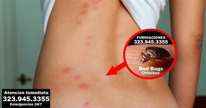 BED BUGS - PEST CONTROL 24/7 image 6