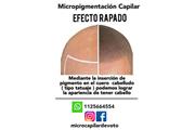 Mícropigmentacion capilar en Buenos Aires