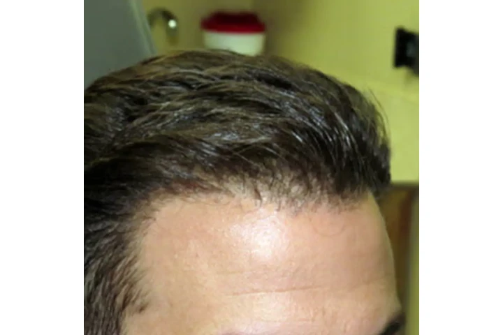 ¿ESTÁS PERDIENDO EL CABELLO? image 5
