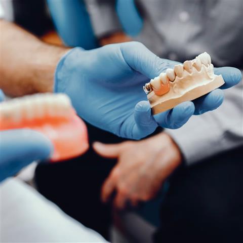 Implantes Dentales en Rialto image 3
