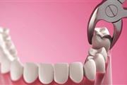 Wisdom Teeth Removal Cost en New York