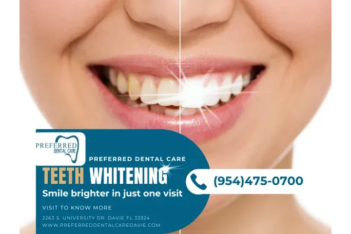 Brighten Your Smile in Davie! image 1