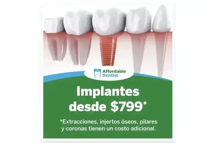 Implantes Dentales desde $799 image 5