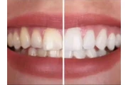 CLINICA DENTAL KORSO en Caracas