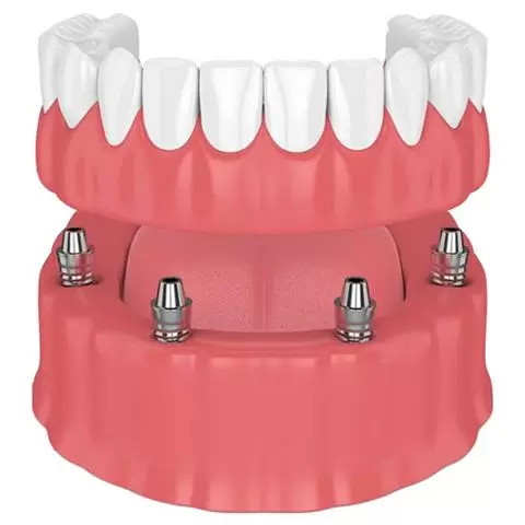 ANGEL DENTAL CARE image 4