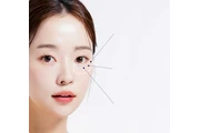 Crema Eye Puff CareCella thumbnail