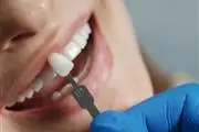 Dentista general y cosmético thumbnail